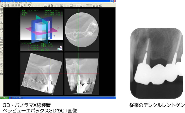 最新の高性能歯科用CT完備